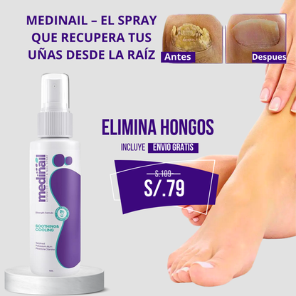 MEDINAIL- TRATAMIENTO PARA UÑAS Y PIES