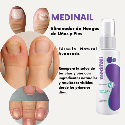 MEDINAIL- TRATAMIENTO PARA UÑAS Y PIES